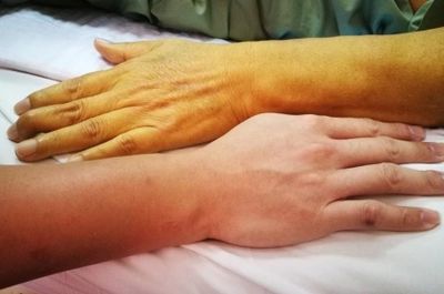 Gặp 6 dấu hiệu này thường xuyên, nên đi khám gan sớm