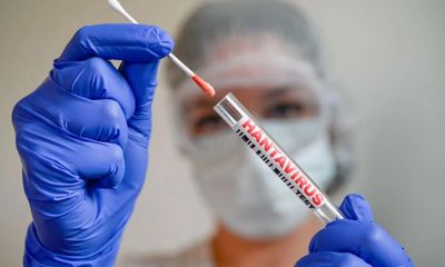 Virus Hanta khác COVID-19 như thế nào?