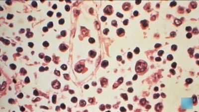Thái Lan nâng mức cảnh báo đối với virus Hanta