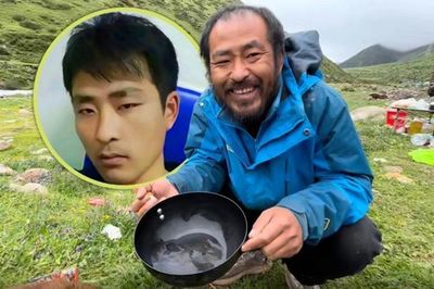 Chàng trai 24 tuổi 'già hóa' như ông chú 50 chỉ sau cú sốc thất tình