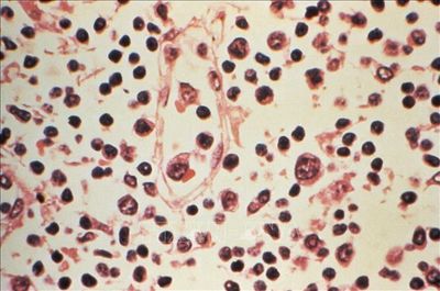 Virus Hanta: Chuyên gia khuyến nghị cách phòng tránh