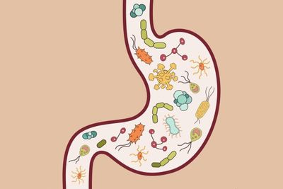 Bệnh viêm ruột mạn gia tăng ở người trẻ tại Việt Nam
