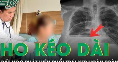 Ho kéo dài nhiều tuần, người phụ nữ bất ngờ phát hiện phổi trái xẹp hoàn toàn vì bệnh hiếm
