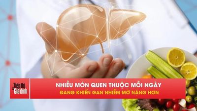 Người bị gan nhiễm mỡ nên tránh xa những món ăn này