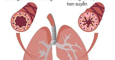Khi nào người bệnh hen cần đến viện ngay lập tức?