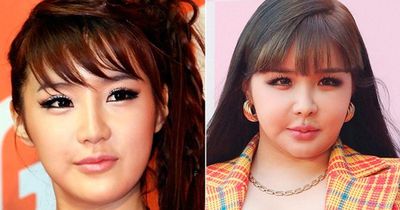 Từ 'át chủ bài' của YG đến biểu tượng lụi tàn vì scandal: Hành trình khiến Kpop tiếc nuối nhất gọi tên Park Bom