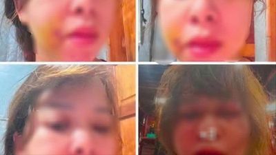 Người vợ ở Đắk Lắk tố cáo bị chồng đánh đập dã man sau sinh