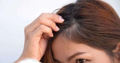 Tóc bạc sớm ở người trẻ ngày càng phổ biến: Chuyên gia cảnh báo nhiều nguyên nhân ít ai ngờ tới