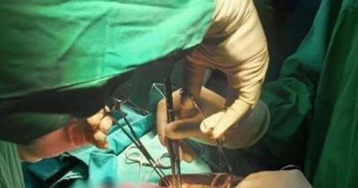 Bé trai 3 tuổi nôn ra giun, khi phẫu thuật bác sĩ phát hiện điều đáng sợ hơn