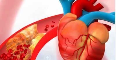 Biện pháp phòng ngừa bệnh tim mạch hiệu quả sau tuổi 30