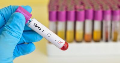 Nguyên tắc '2 - 5 - 30' ngăn Ebola lây lan