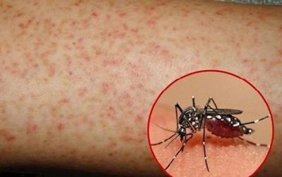 Hơn 1.100 ca mắc sốt xuất huyết, Lâm Đồng kích hoạt các biện pháp phòng, chống dịch