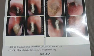 Vụ niềng răng bị thủng xoang mũi: Lập hội đồng chuyên môn rà soát quy trình