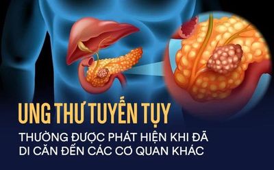 Cơ hội kéo dài thời gian sống của bệnh nhân ung thư tuyến tụy di căn