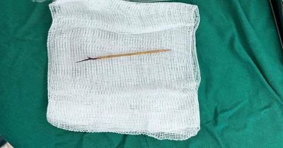 Bác sĩ sốc khi phát hiện chiếc tăm tre cắm trong tim bé trai 13 tuổi