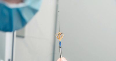Chữa thành công bệnh rung nhĩ bằng năng lượng xung điện (PFA)