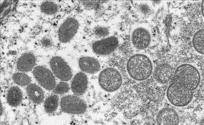 Hai nhà nghiên cứu bị truy tố vì đưa trái phép virus đậu mùa khỉ vào Mỹ