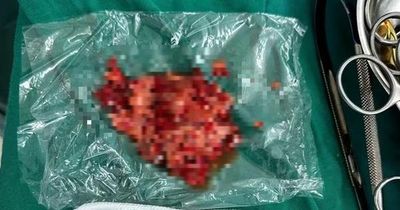 Bé trai 13 tuổi nguy kịch vì mải miết ăn uống theo cách 'lạ đời'