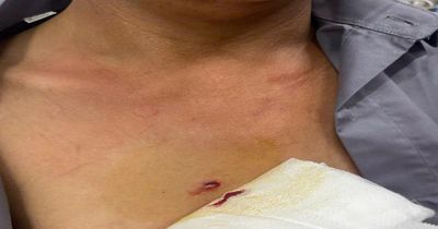 Súng tự chế cướp cò, người đàn ông bị đạn găm thẳng vào ngực