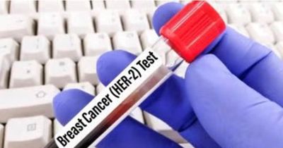 FDA ưu tiên xem xét đơn đăng ký thuốc giredestrant của Roche trong điều trị ung thư vú