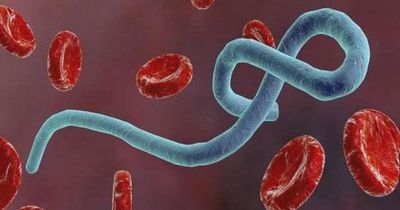 Chuyên gia y tế nói về đường lây truyền của Ebola