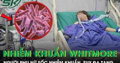Người phụ nữ 43 tuổi sốc nhiễm khuẩn, suy đa tạng sau 5 ngày sốt