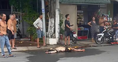 Nam thanh niên bỏng nặng nghi do phóng hỏa tiệm giặt sấy ở Cà Mau