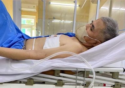 Sốt kéo dài, người đàn ông phải dẫn lưu 2 chai mủ màng phổi