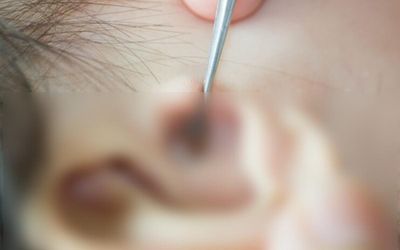 Phát hiện bọ chét ký sinh trong màng nhĩ bé gái 2 tuổi