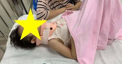 Chơi cầu trượt, bé gái 4 tuổi Hà Nội nhập viện sau khi bị một bé trai đẩy ngã từ độ cao 1,5m, chấn thương nặng