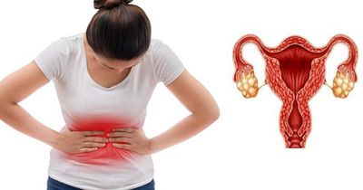 Người phụ nữ 25 tuổi mắc hội chứng buồng trứng đa nang vẫn sinh con khỏe mạnh nhờ làm điều này