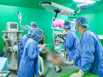Nội soi cấp cứu gắp khuyên tai sắc nhọn trong thực quản bé gái 11 tháng tuổi