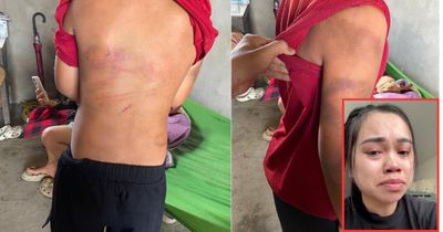 Nghệ An: Mẹ tố cha ruột bạo hành con trai 10 tuổi