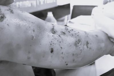 Nuôi chó Phốc sóc bệnh dại, gia chủ bị cắn bất ngờ