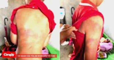 Xác minh vụ cháu bé 10 tuổi nghi bị bạo hành