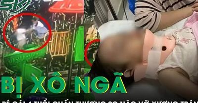 Bé gái 4 tuổi bị bạn xô ngã từ cầu trượt cao 1,5m chấn thương sọ não vỡ xương trán