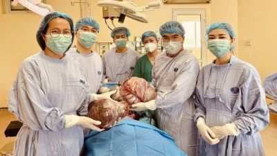Phẫu thuật thành công cho nữ sinh mang hai khối u buồng trứng khổng lồ nặng gần 15kg