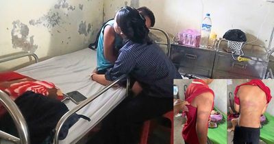 Vụ bé trai ở Nghệ An nghi bị bạo hành: Người mẹ từ Nga vào thẳng viện với con