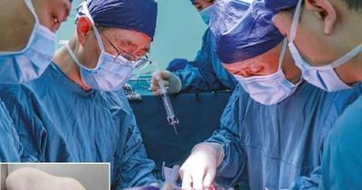 Bước đột phá y học: Lần đầu ghép đồng thời gan và thận lợn cho người