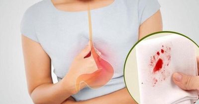 Người phụ nữ 63 tuổi phát hiện ung thư dạ dày từ dấu hiệu nhiều người Việt thường bỏ qua