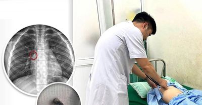 Được mẹ nhổ răng tại nhà, bé trai phải đi cấp cứu sau sự cố hi hữu
