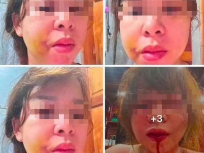 Người phụ nữ cầu cứu sau nhiều lần bị chồng hành hung