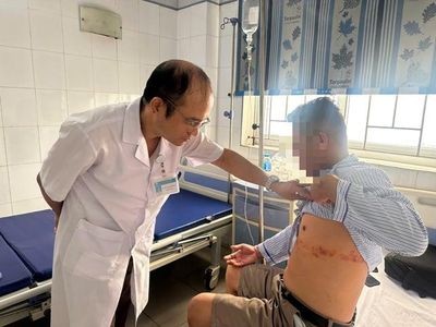 Chủ quan với zona thần kinh, người đàn ông 43 tuổi nhập viện vì tổn thương da lan rộng