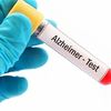 Bộ xét nghiệm máu mới giúp phát hiện sớm bệnh Alzheimer