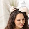 Có nên sử dụng Exosome để kích thích mọc tóc?