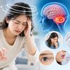 Chóng mặt, buồn nôn, mất thăng bằng: Khi nào là dấu hiệu đột quỵ?