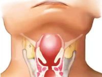 Những lần dịch bạch hầu bùng phát trong lịch sử nhân loại