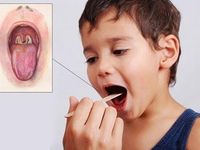 Rửa tay với xà phòng: Tránh 3 dịch bệnh nguy cơ bùng phát