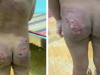 Báo động bạo hành trẻ em: Phần nổi của tảng băng chìm