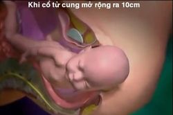 Cận cảnh khoảnh khắc em bé chui ra khỏi cơ thể người mẹ